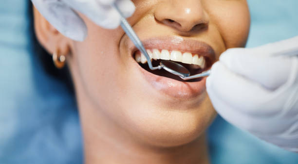 Best Emergency Treatment for Oral Infections in Eagle Lake, MN